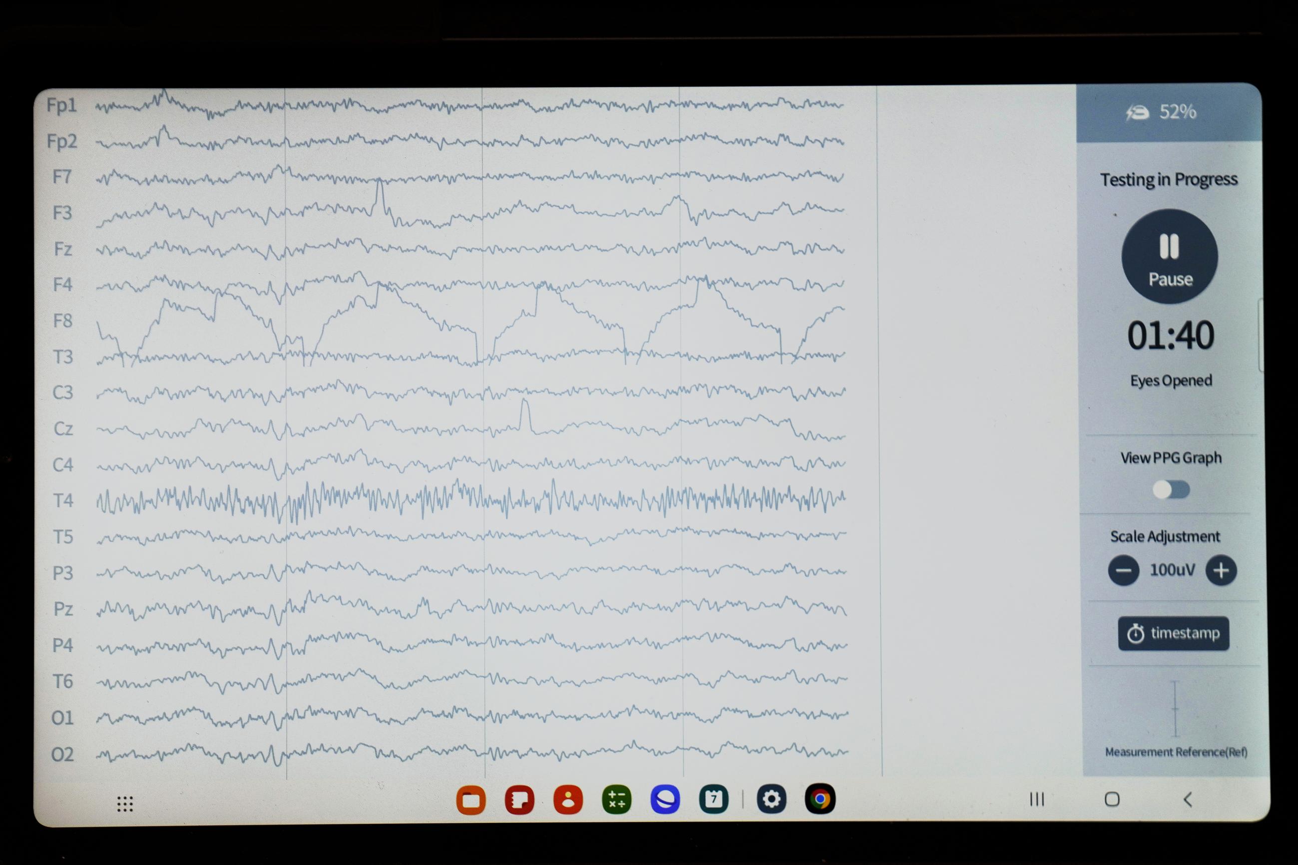 A brain wave is shown at the iMediSync booth during the CES tech show in Las Vegas in 2023. (AP Photo/Rick Bowmer)